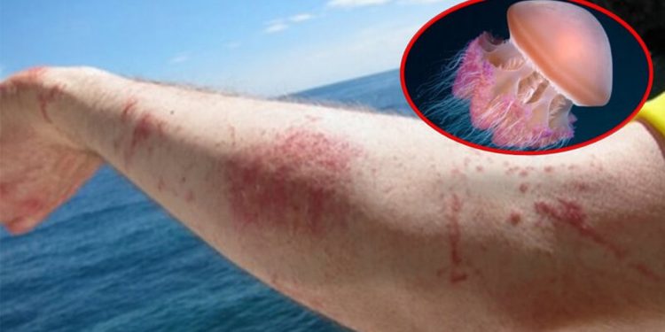 Sứa lửa thực sự là nỗi khiếp đảm của bà con ngư dân đi biển